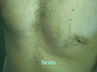 Sexto